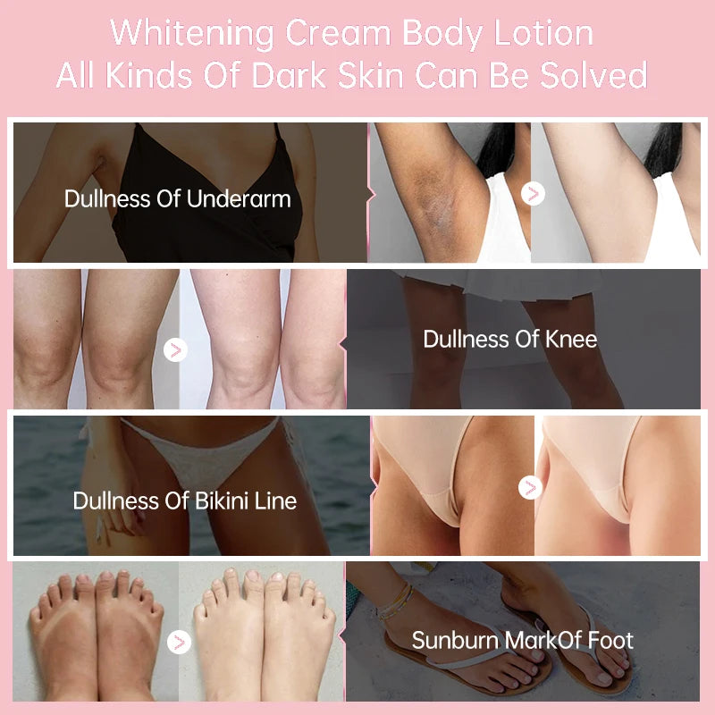 Body Whitening Cream Private Parts Underarm Knee Thigh Inner Melanin Bleaching Brighten Lotion Dark Skin Healthy White Body Care