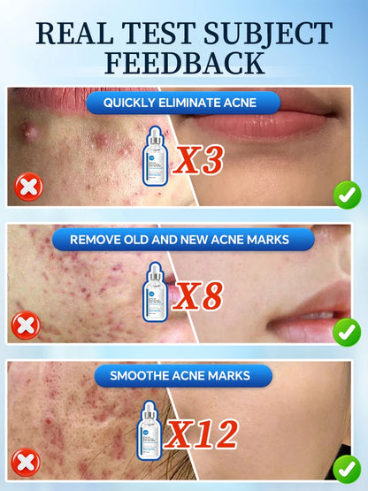 Solve Skin Problems For You