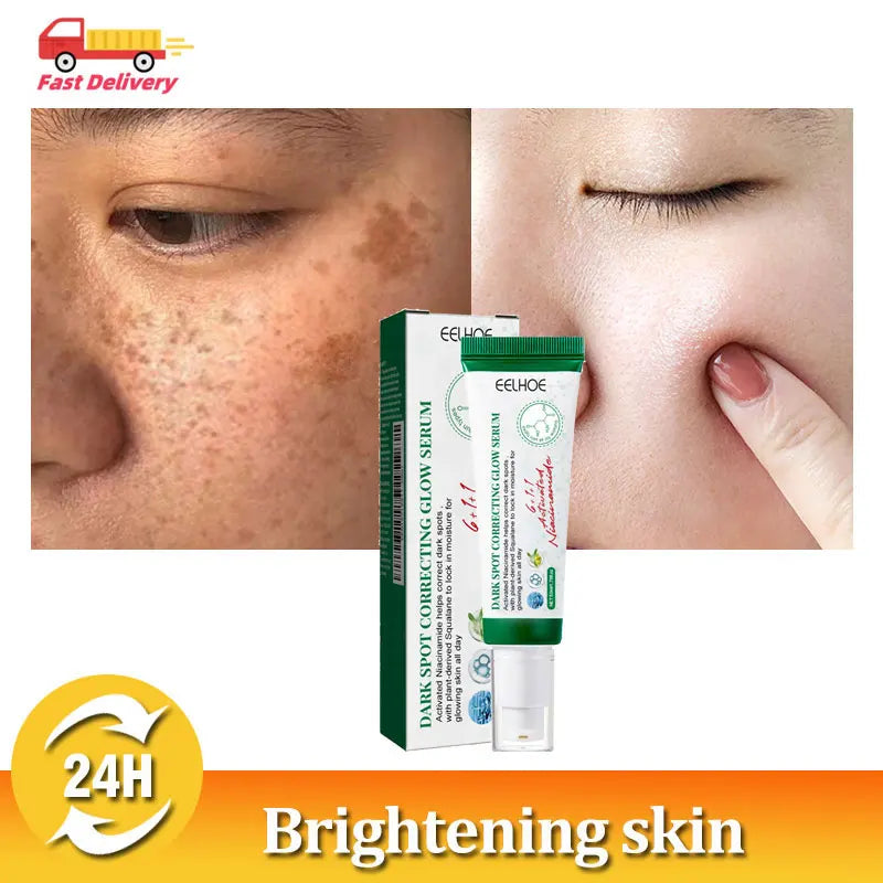 Nicotinamide Intense Anti Dark Spots Serum Cream Whitening Fade Freckles Melasma Remover Treatment Brightening Skin Care 50g