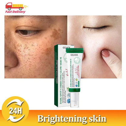 Nicotinamide Intense Anti Dark Spots Serum Cream Whitening Fade Freckles Melasma Remover Treatment Brightening Skin Care 50g