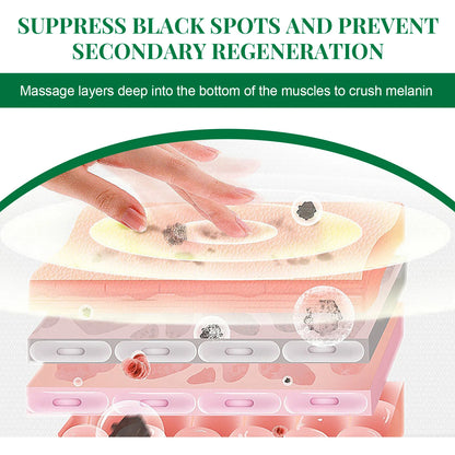 Nicotinamide Intense Anti Dark Spots Serum Cream Whitening Fade Freckles Melasma Remover Treatment Brightening Skin Care 50g