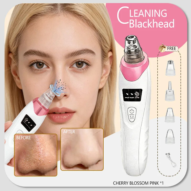 Professional Blackhead Vacuum - Rechargeable Pore Extractor for Blackheads, Oily Skin & Facial Cleansing