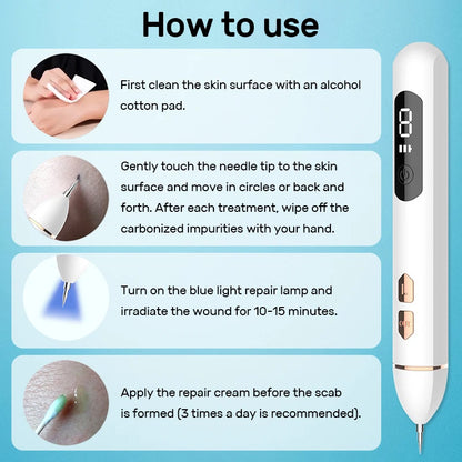 Laser Plasma Pen Mole Wart Skin Tag Remover Black Dots Freckle Dark Spot Wart Eliminator Papilloma Nevus Remover Plasma Pen