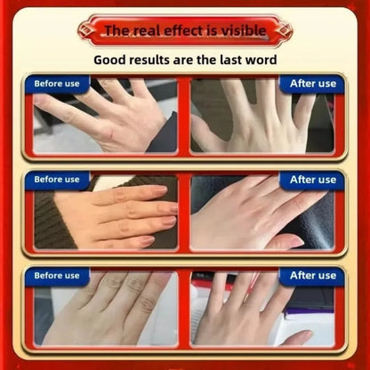Anti-Wrinkle Hand Cream – Smoothing & Nourishing Cream for Finger Joints & Rough Skin