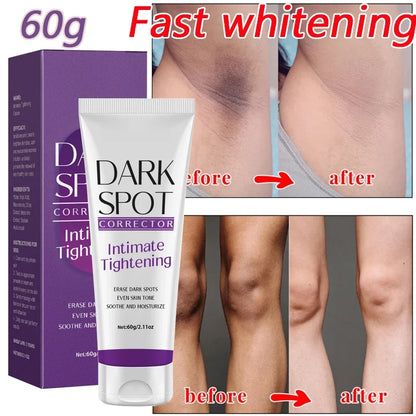 Body Whitening Cream Private Parts Underarm Knee Thigh Inner Melanin Bleaching Brighten Lotion Dark Skin Healthy White Body Care