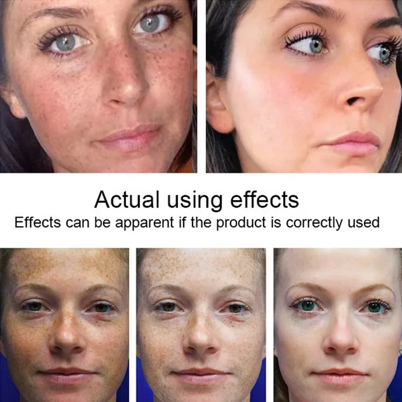 White Rice Whitening Cream Remove Dark Spots Fade Freckle Melanin Repair Product Anti Wrinkle Moisturizing Brighten Facial Care