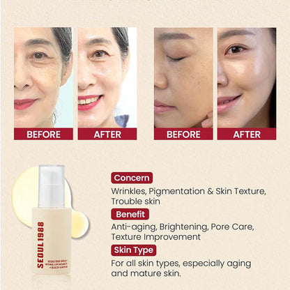 Seoul 1988 Korean Skin Care Set Snail Mucin Eye Contour Care Vitamin C Retinol Dark Circles Removal Seoul 1988 Korean Cosmetics