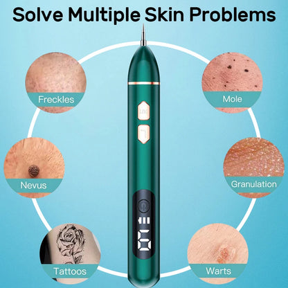 Laser Plasma Pen Mole Wart Skin Tag Remover Black Dots Freckle Dark Spot Wart Eliminator Papilloma Nevus Remover Plasma Pen