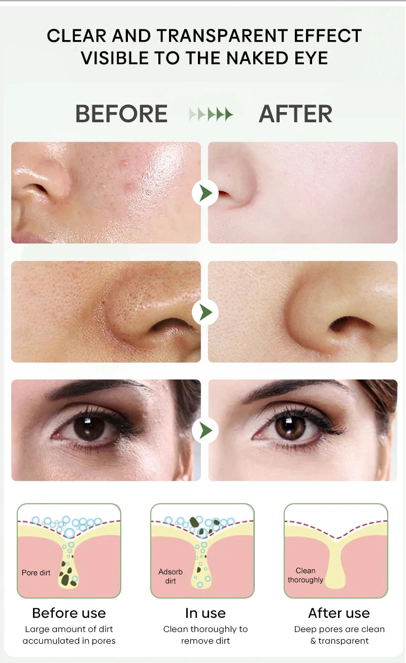 Original Facial Remove Blackhead Green Tea Solid Mask Treat Acne Blemish Black Dots Clean Stick Cream Shrink Pores Skin Care