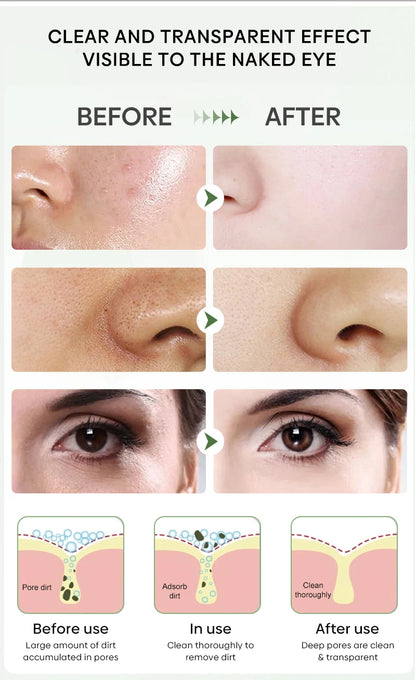 Original Facial Remove Blackhead Green Tea Solid Mask Treat Acne Blemish Black Dots Clean Stick Cream Shrink Pores Skin Care