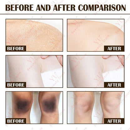 Sakura Skin Whitening Cream Dark Spots Removal Bleach Body Care Lotion Permanently Woman Beauty Moisturizing Korean Cosmetics