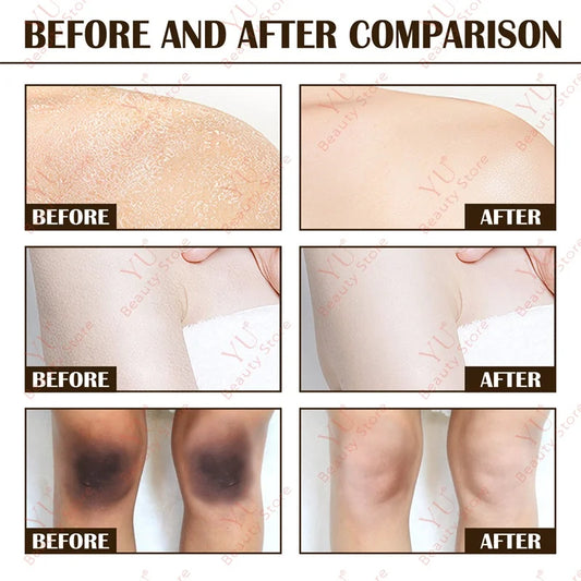 Sakura Skin Whitening Cream Dark Spots Removal Bleach Body Care Lotion Permanently Woman Beauty Moisturizing Korean Cosmetics