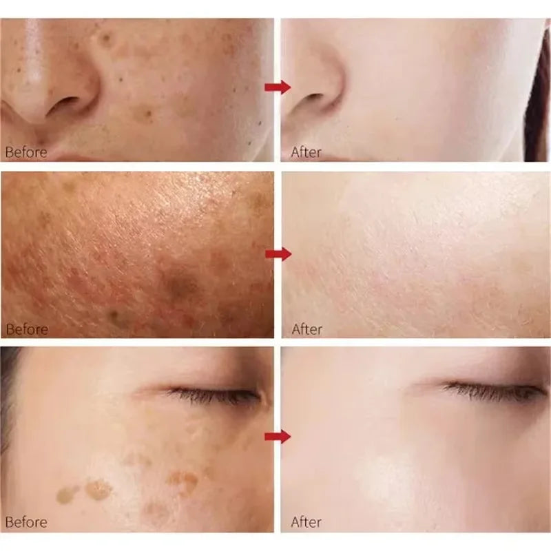 White Rice Whitening Cream Remove Dark Spots Fade Freckle Melanin Repair Product Anti Wrinkle Moisturizing Brighten Facial Care