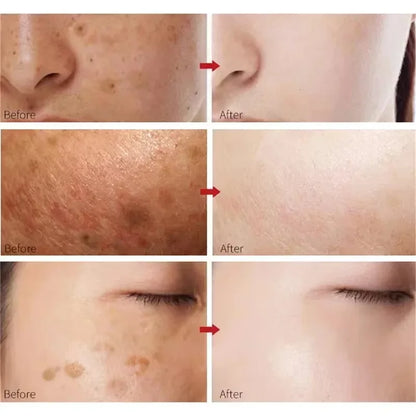White Rice Whitening Cream Remove Dark Spots Fade Freckle Melanin Repair Product Anti Wrinkle Moisturizing Brighten Facial Care