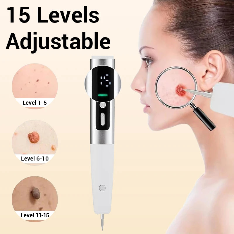 Laser Plasma Pen Mole Wart Skin Tag Remover Black Dots Freckle Dark Spot Wart Eliminator Papilloma Nevus Remover Plasma Pen