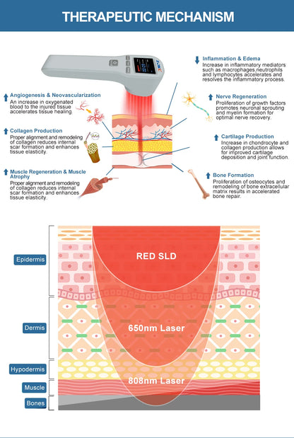 ZJKC Professional Pain Relief Physiotherapy Cold Laser Therapy Device for Pet Dog Cat Wound Injuries 650nm 808nm Home Handheld