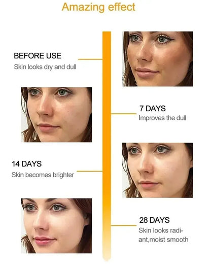 Effective whitening cream for freckles, removes Melasma, dark spots, pigmentation, moisturizer, lightens the face,