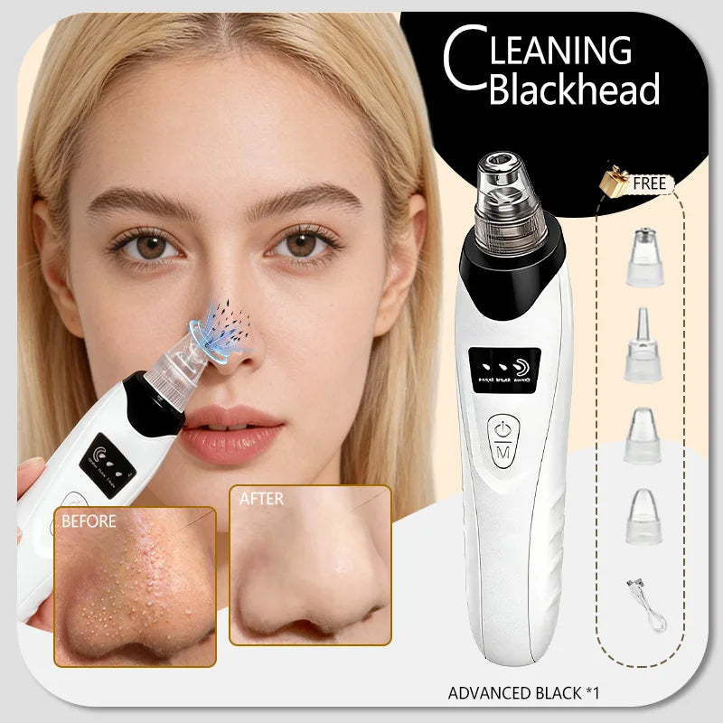 Professional Blackhead Vacuum - Rechargeable Pore Extractor for Blackheads, Oily Skin & Facial Cleansing
