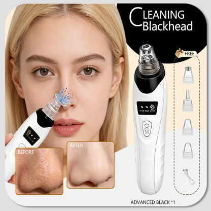 Professional Blackhead Vacuum - Rechargeable Pore Extractor for Blackheads, Oily Skin & Facial Cleansing