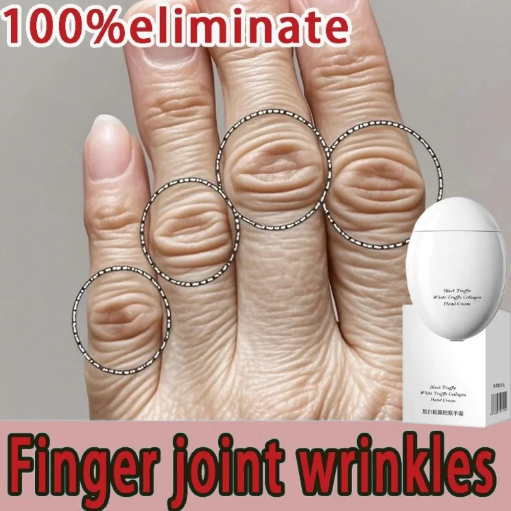 Anti-Wrinkle Hand Cream – Smoothing & Nourishing Cream for Finger Joints & Rough Skin