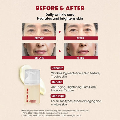Seoul 1988 Korean Skin Care Set Snail Mucin Eye Contour Care Vitamin C Retinol Dark Circles Removal Seoul 1988 Korean Cosmetics