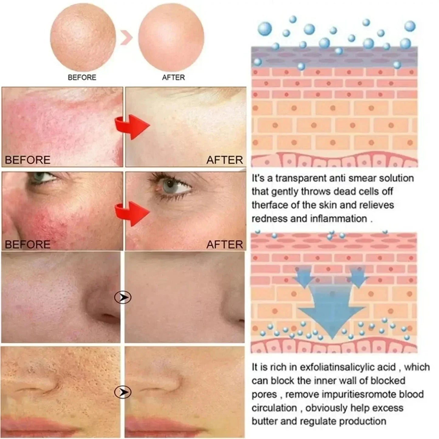 Repair Facial Redness Cream Instant Spider Vein Remove Sensitive Skin Sooth Anti Redness Rosacea Treat Lotion Korean Cosmetics