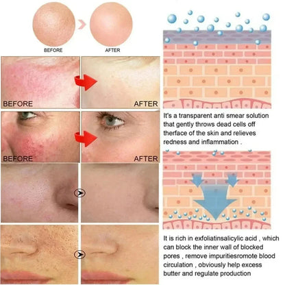 Repair Facial Redness Cream Instant Spider Vein Remove Sensitive Skin Sooth Anti Redness Rosacea Treat Lotion Korean Cosmetics