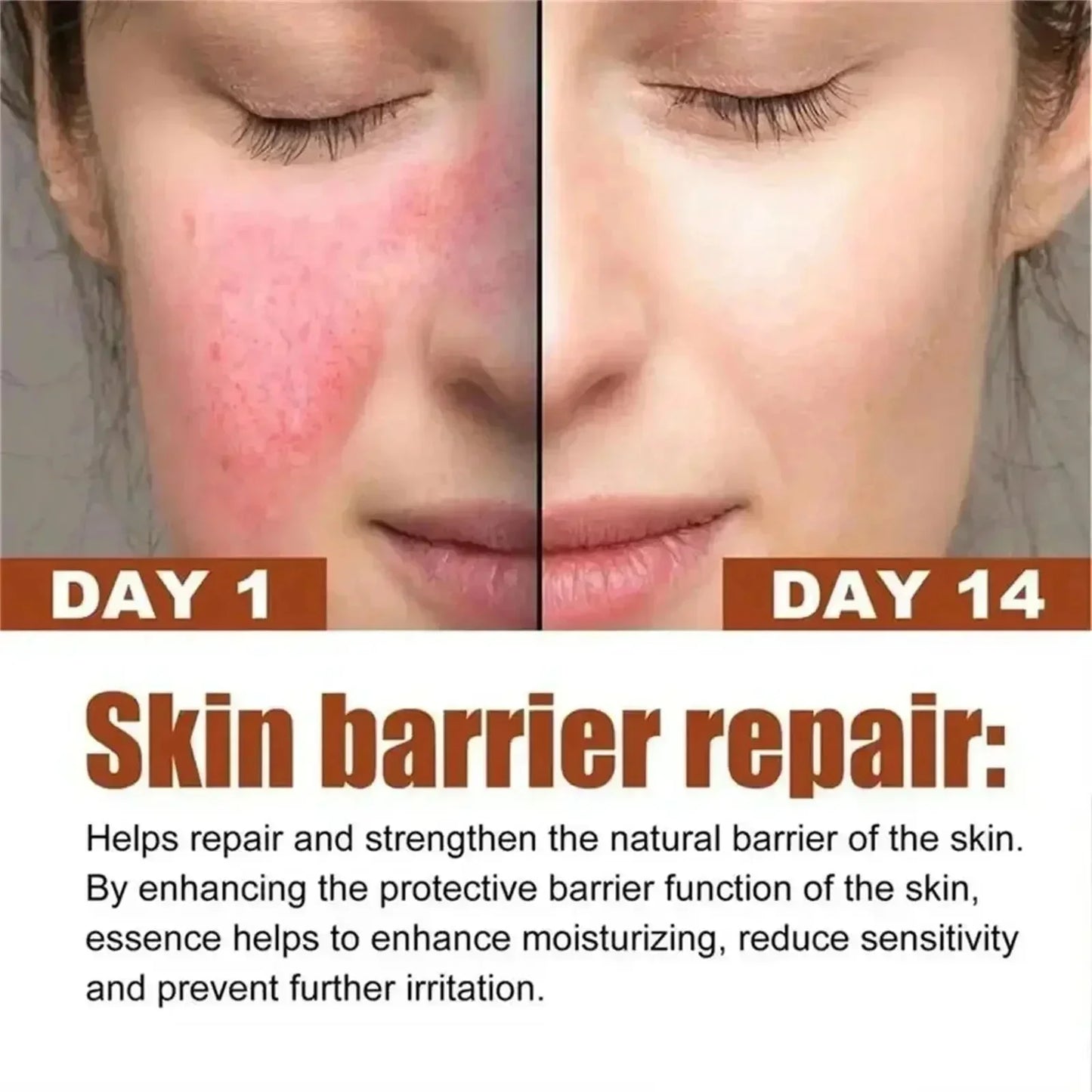 Repair Facial Redness Cream Instant Spider Vein Remove Sensitive Skin Sooth Anti Redness Rosacea Treat Lotion Korean Cosmetics