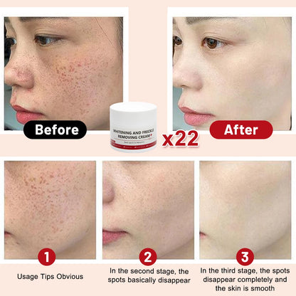Whitening Freckle Cream Melasma Dark Spots Pigmentation Removal Products Fade Stain Melanin Repair Brighten  Skin Care
