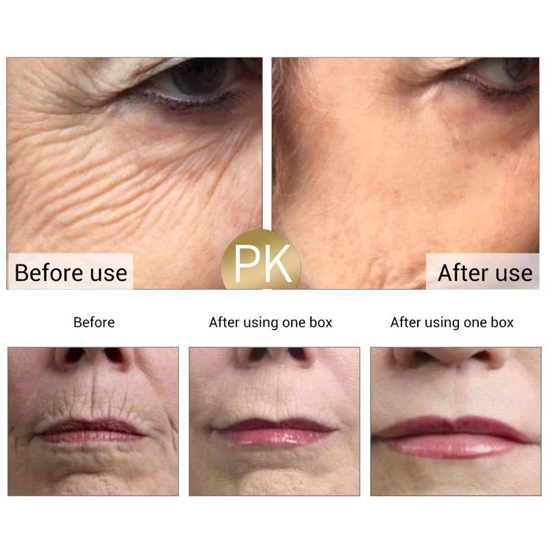 Retinol Wrinkle Remover Cream Shot Tightening Firming Fine Line Enhancer Moisturizing Pore Shrinking Repair Serum Skin Care Set