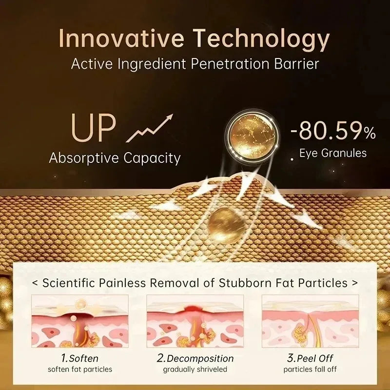 Fat Granules Remover Eye Cream Effective Remove Fat Granules Puffiness Anti-Particles Milia Remover Product Repair Eye Skin Care