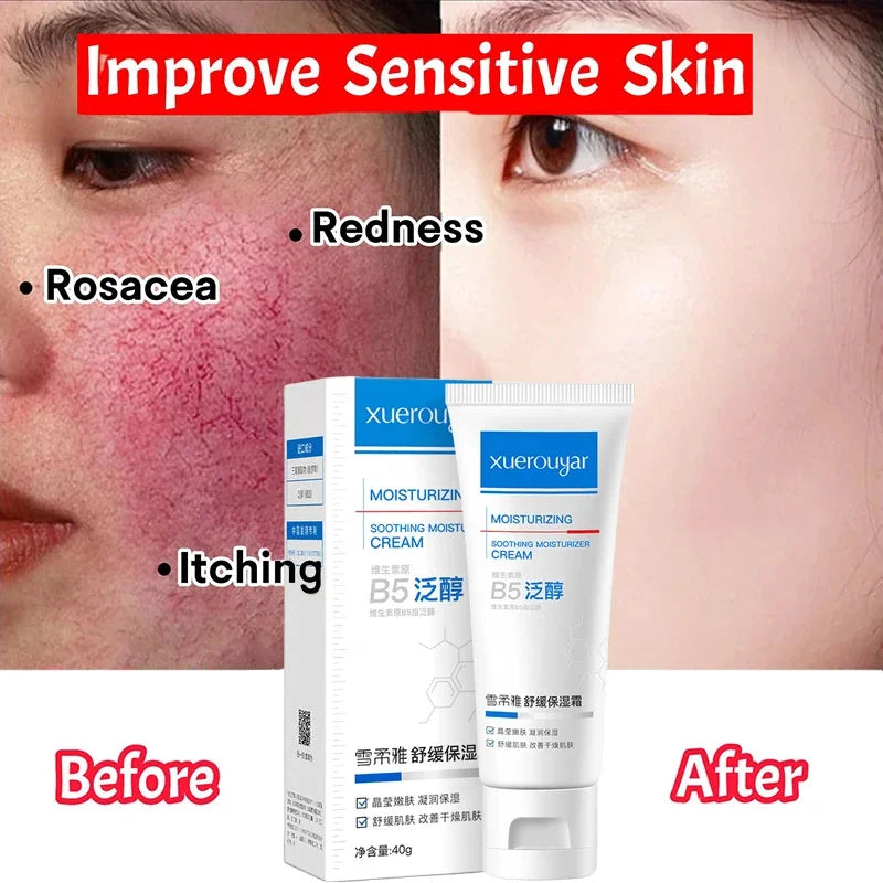 B5 Repair Facial Redness Cream Instant Spider Vein Remove Sensitive Skin Sooth Anti Redness Rosacea Treat Lotion Korean Cosmetic