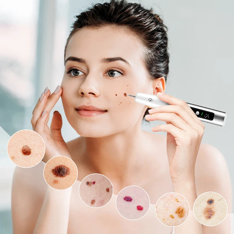 Laser Plasma Pen Mole Wart Skin Tag Remover Black Dots Freckle Dark Spot Wart Eliminator Papilloma Nevus Remover Plasma Pen