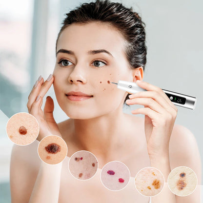 Laser Plasma Pen Mole Wart Skin Tag Remover Black Dots Freckle Dark Spot Wart Eliminator Papilloma Nevus Remover Plasma Pen