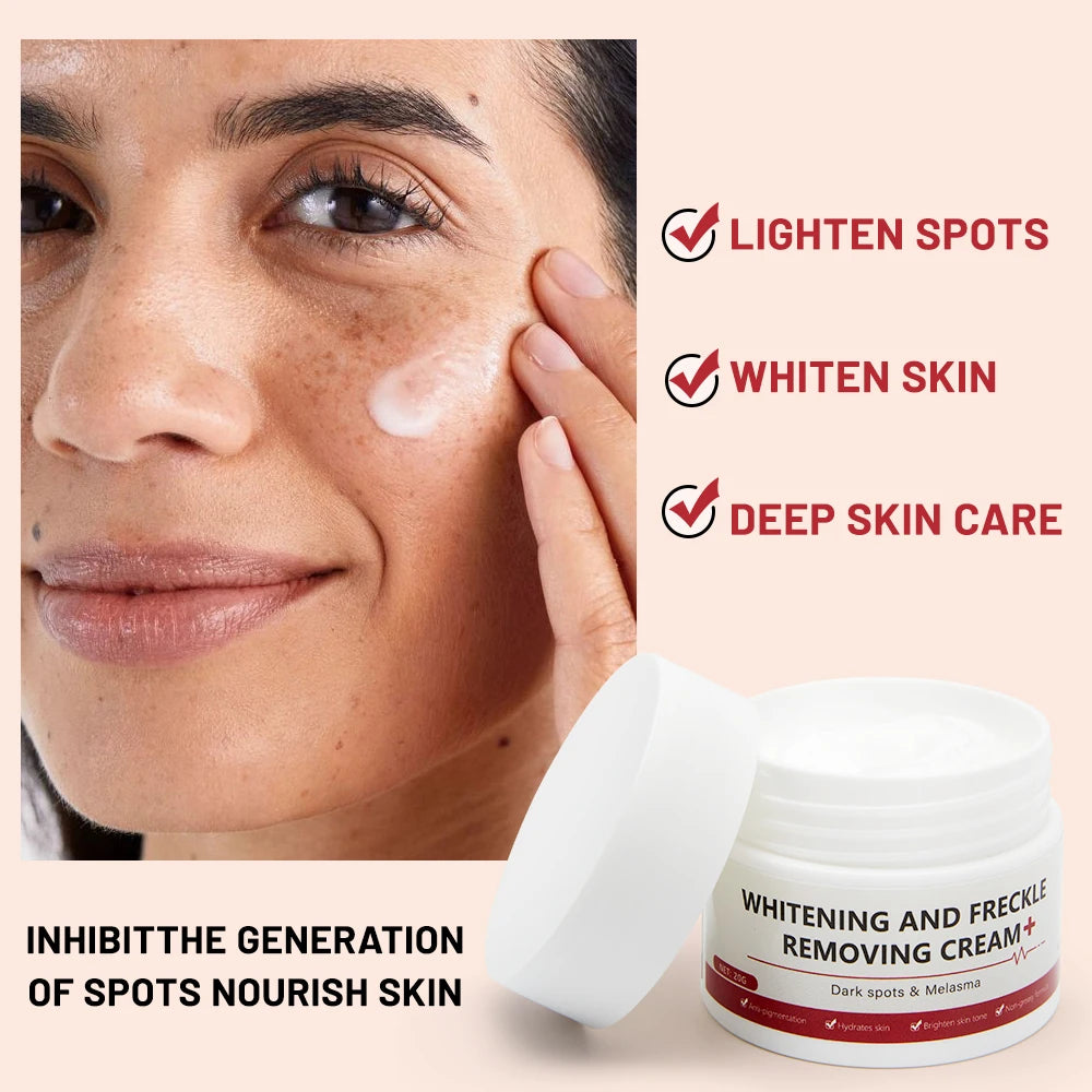 Whitening Freckle Cream Melasma Dark Spots Pigmentation Removal Products Fade Stain Melanin Repair Brighten  Skin Care