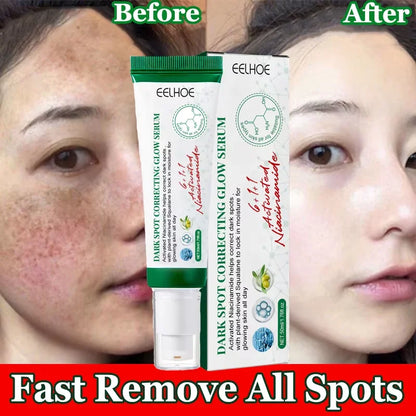Nicotinamide Intense Anti Dark Spots Serum Cream Whitening Fade Freckles Melasma Remover Treatment Brightening Skin Care 50g