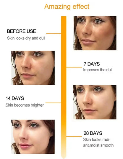 Retinol Whitening Freckle Cream Melasma Dark Spots Pigmentation Removal Fade Stain Melanin Fast Repair Brighten Korean Skin Care