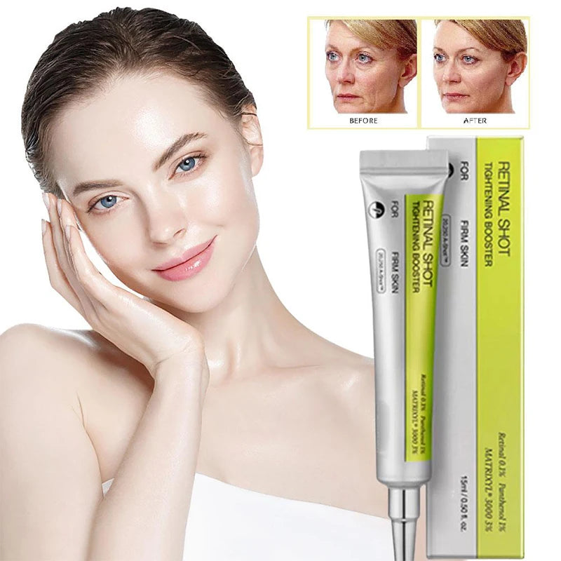 Korean Eye Cream For Anti-wrinkle & Age Retinol Eye Cream Remove Dark Circles Against Puffiness And Bags Hydrate Eye Care Cream