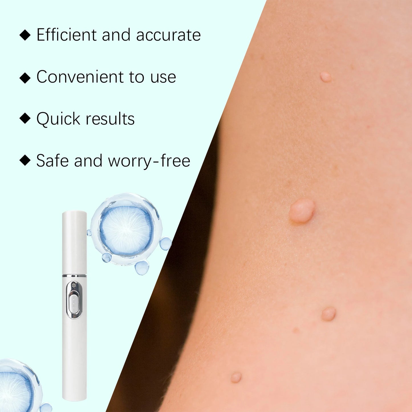 Face Beauty Laser Pen Improve Dark Spot Freckles Pigmentation Lighten Dull Skin Glowing Painless Facial Blemishes Removal Device
