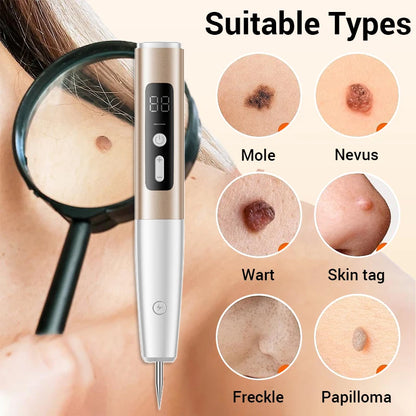 Laser Plasma Pen Mole Wart Skin Tag Remover Black Dots Freckle Dark Spot Wart Eliminator Papilloma Nevus Remover Plasma Pen