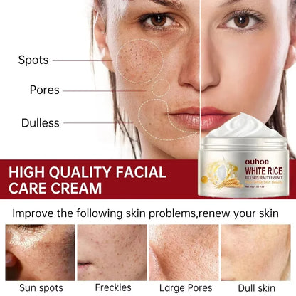 White Rice Whitening Cream Remove Dark Spots Fade Freckle Melanin Repair Product Anti Wrinkle Moisturizing Brighten Facial Care