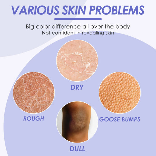 Body Whit-ening Milk Bleaching Lightening Private Part Moisturizing Smoothing Chicken Skin Remove Me-lanin Brightening Lotion