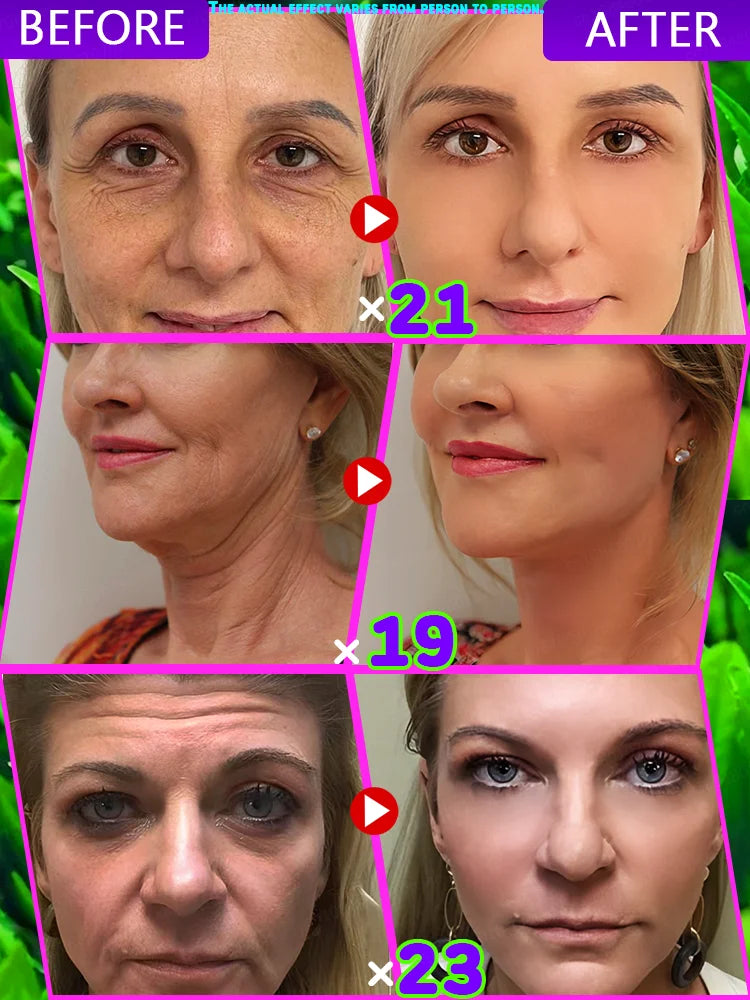 Contains peptides, retinol facial anti-aging cream, vitamin e hyaluronic acid for wrinkle repair anti-wrinkle moisturizing.